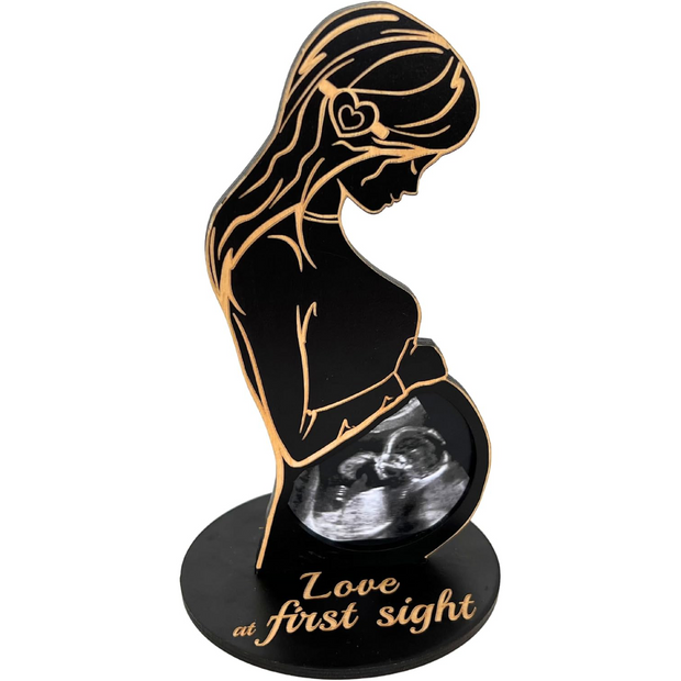 Pregnancy Frame – Cherish the First Ultrasound Memory of Your Baby