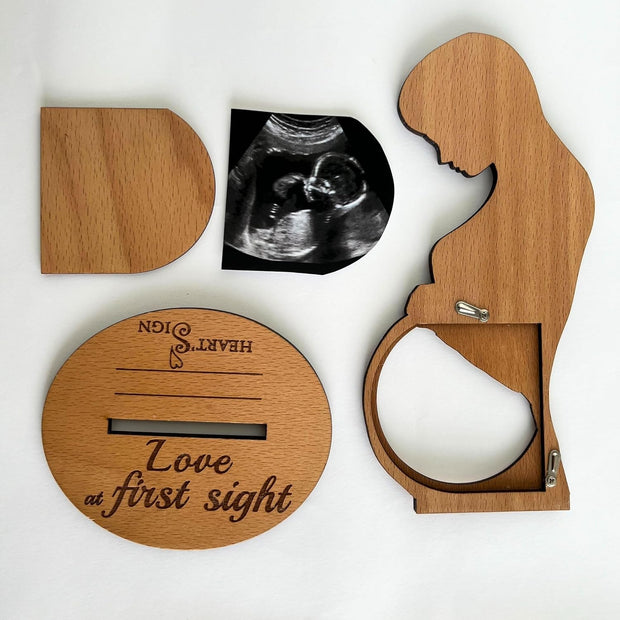Pregnancy Frame – Cherish the First Ultrasound Memory of Your Baby